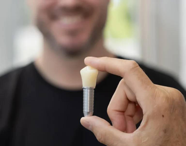 Implantat mit Krone am Modell, erklärt beim Zahnarzt in Bad Oldesloe